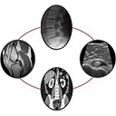 Brighton Radiology logo