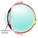 Evolution Eye Care logo