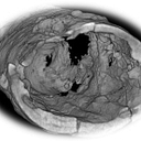 Soundbite Medical Solutions Inc. logo